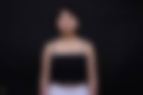 术后成都青羊雅肤媛的贴心护理与惊人成效