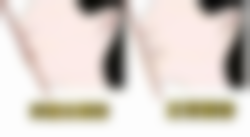 17岁孩子牙齿矫正算不算晚