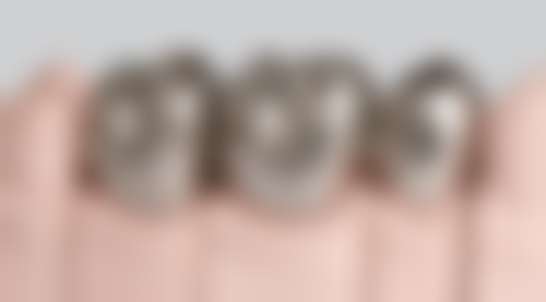 种植牙国内集采大概还要等多久