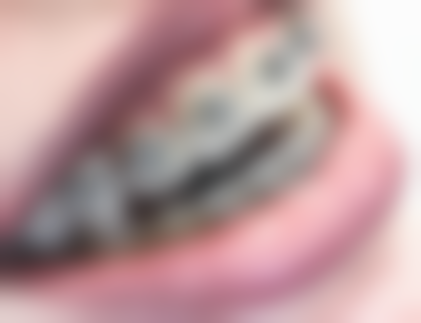 家长配合与日常管理