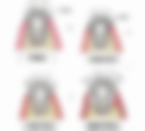 韩国 DIO 种植系统型号