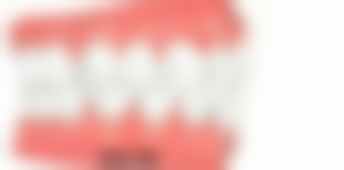 地包天矫正效果怎么样？矫正后脸型变化超明显，90%患者满意度高，告别自卑重拾自信！ 