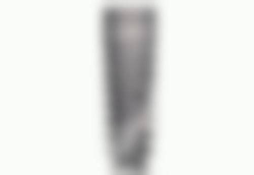 地包天牙齿矫正器图片