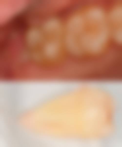 【镇江市乐康口腔诊所(润州区)参考价格表：】