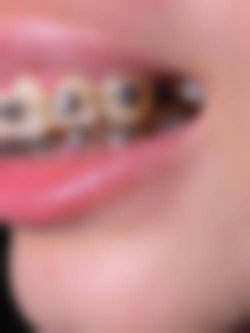 【济南银峰口腔怎么预约挂号?】