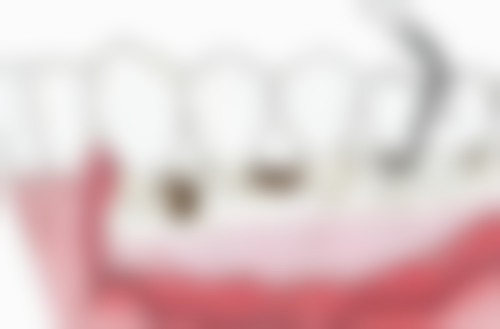 关于掉牙和牙齿数量的小知识