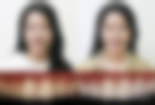 【东莞石排舒倍口腔门诊是正规的吗?】