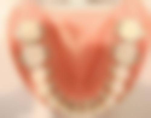 自己能否矫正地包天