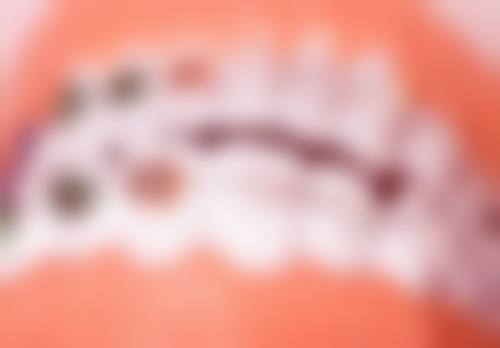 牙防所、口腔颌面外科种植的自费与医疗保险情况