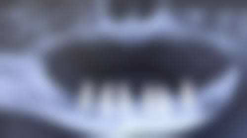 【苏世平医生擅长项目】