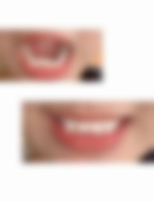 【郑琛医生荣誉资质】