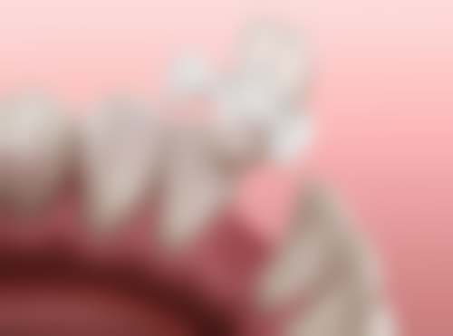 地包天矫正后悔一辈子？