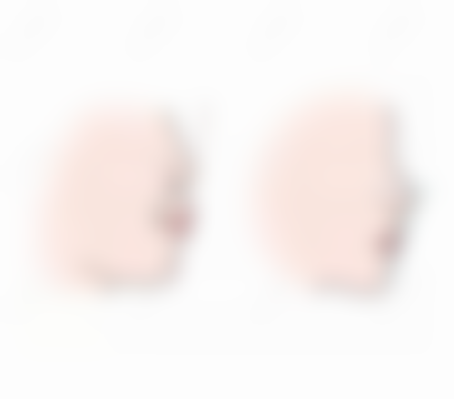 常见矫正方式及价格