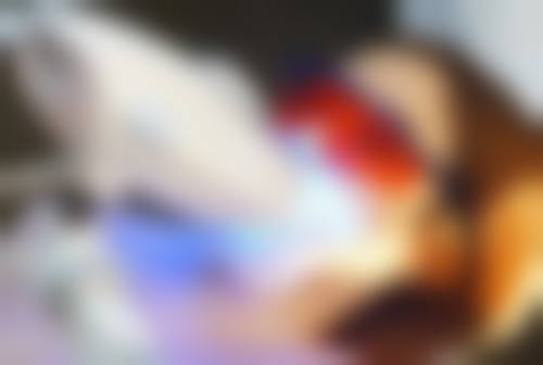 根尖1/3处折断的患牙处理