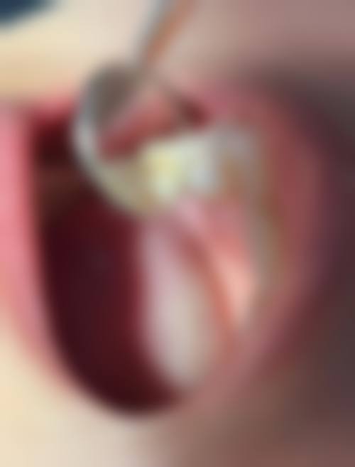 【耿卫艳医生擅长项目：】