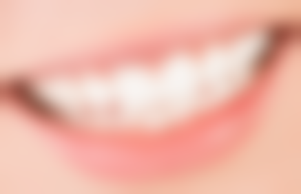 后牙牙体缺损修复方案的选择