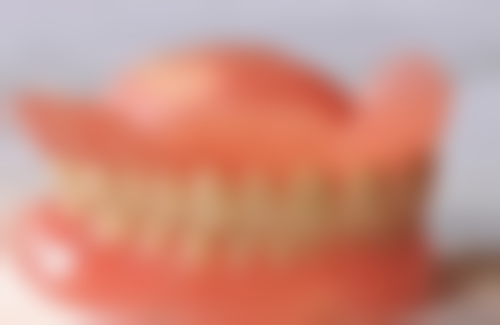 儿童轻微地包天怎么矫正