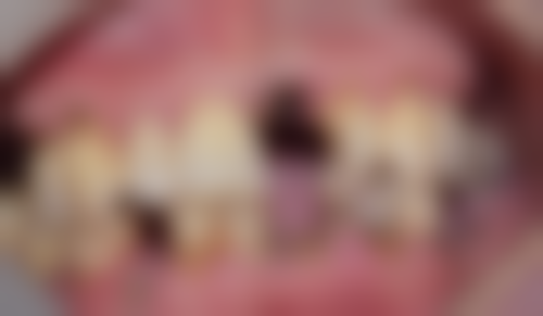 【郑琛医生技术特点:】