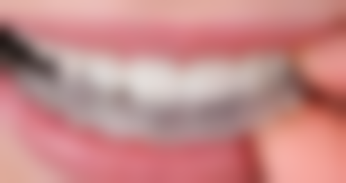 韩国种植牙与美国种植牙的品牌情况