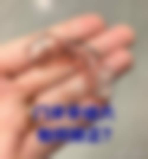 【增城大拇指口腔门诊部参考价格表:】