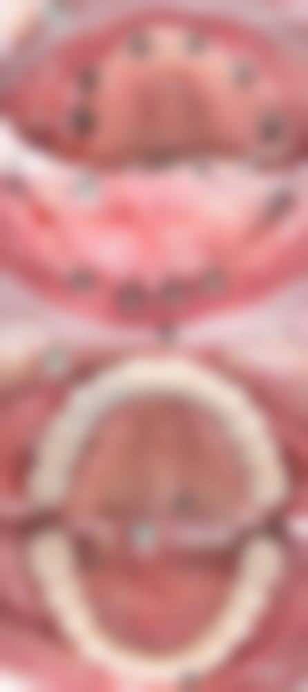 【善尔美口腔诊所参考价格表：】