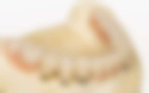 【郭青芳医生技术特点:】