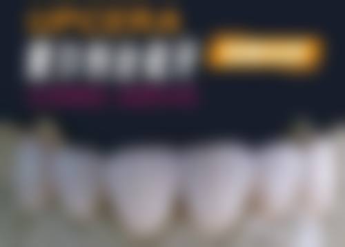 上海半口牙齿种植需要多少钱?