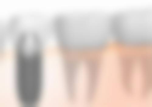 【郑琛医生口碑怎么样?】