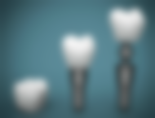 7 岁男孩地包天矫正多长时间能矫正过来