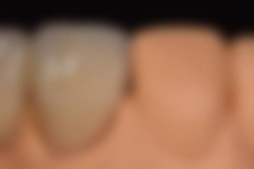 【郭青芳医生擅长项目:】