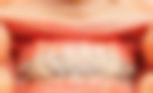 【江苏镇江紫金口腔诊所参考价格表：】