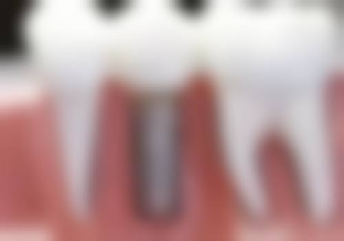 【郑琛医生擅长项目】