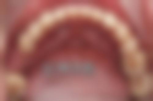 【邓艳南医生技术特点】