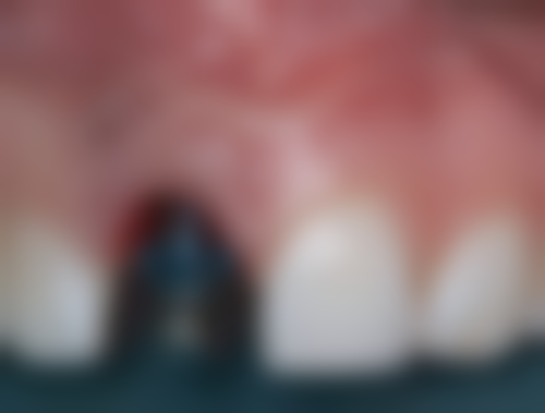 【耿卫艳医生技术特点】