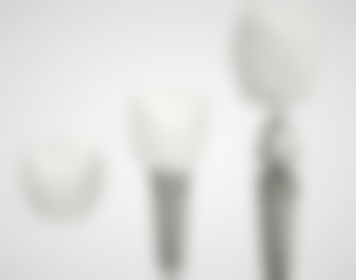 整形牙齿矫正需要拔牙吗多少钱