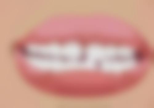 牙齿地包天矫正至佳年龄段