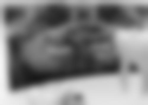 拔牙后种植体多久后可装牙？掌握3个关键因素，最快3个月就能装上，告别缺牙苦恼！ 