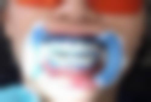 种植牙更贵的多少钱一颗