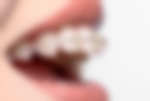 根尖1/3处折断的患牙处理