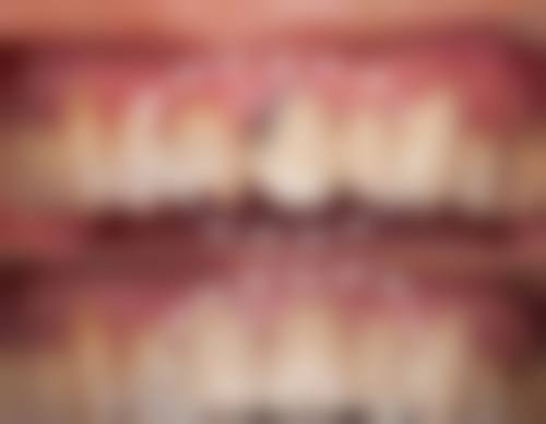 【郭青芳医生技术特点:】