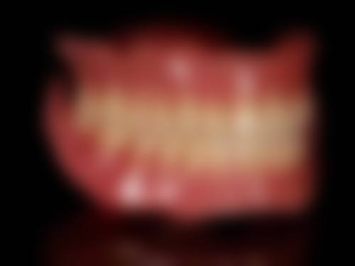 矫正牙齿需要多少费用