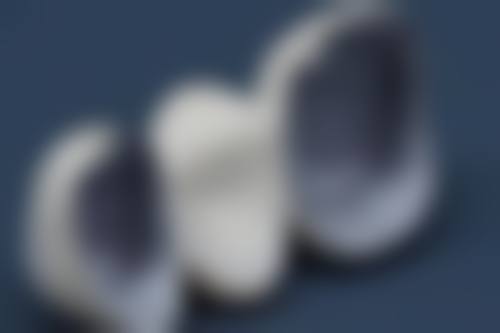 种植牙齿跟镶牙有什么区别？了解两者差异，为你揭秘哪种方式更适合恢复口腔健康和提升生活品质！ 