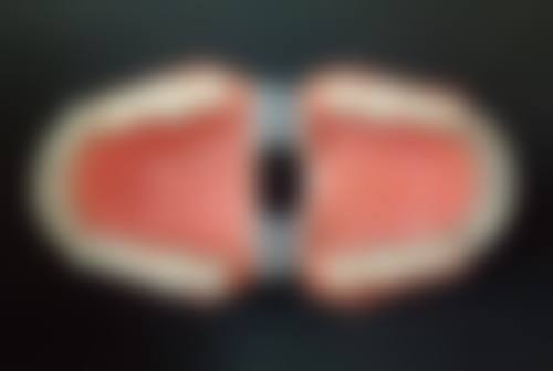 小孩子牙齿矫正多长时间？答案揭晓！通常半年到两年不等，了解矫正周期避免走弯路！ 