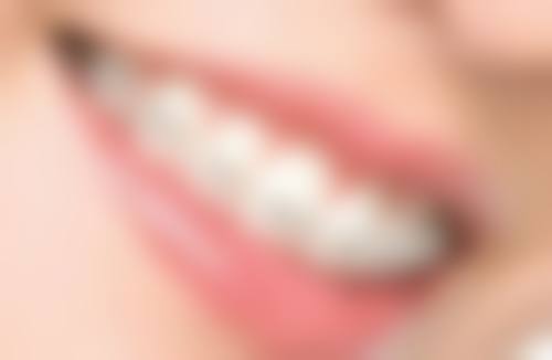 韩国纽百特种植体和奥齿泰的对比