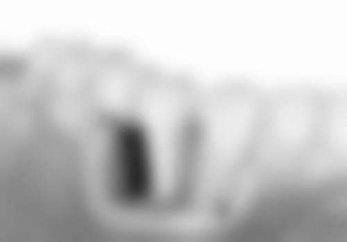 河南南阳方城万超口腔杨笑草医生种植牙技术优势