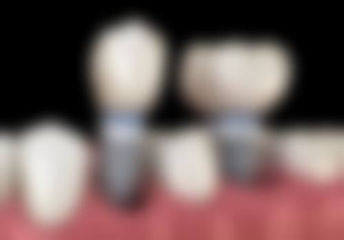 【田晓晰医生怎么预约挂号?】