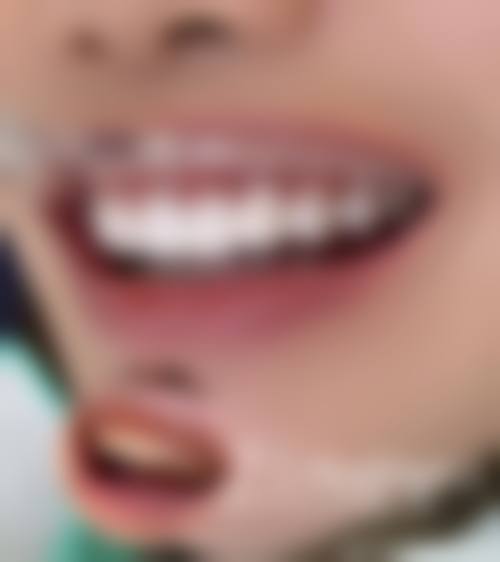 【郑中通医生口碑怎么样?】