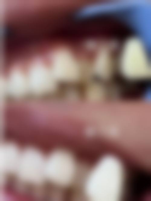 【泉州盛安口腔门诊部(丰泽万达店)患者口碑评价:】