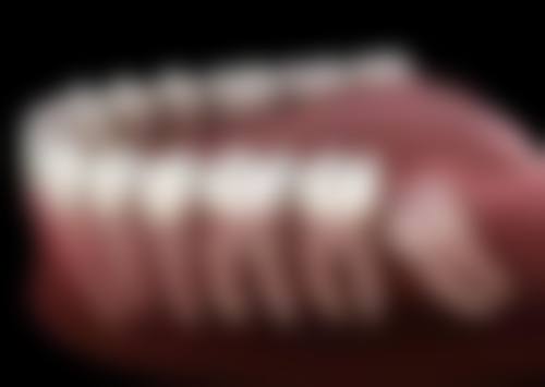 儿童全麻补牙有危险吗？