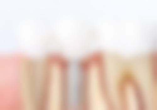 【叶丽萍医生擅长项目】